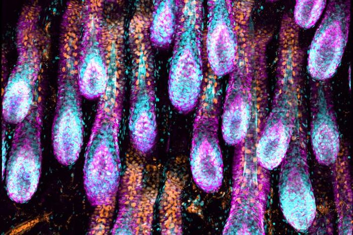 Growing hair follicles. / Credit/Copyright: Robin Chemers Neustein Laboratory of Mammalian Cell Biology and Development at The Rockefeller University