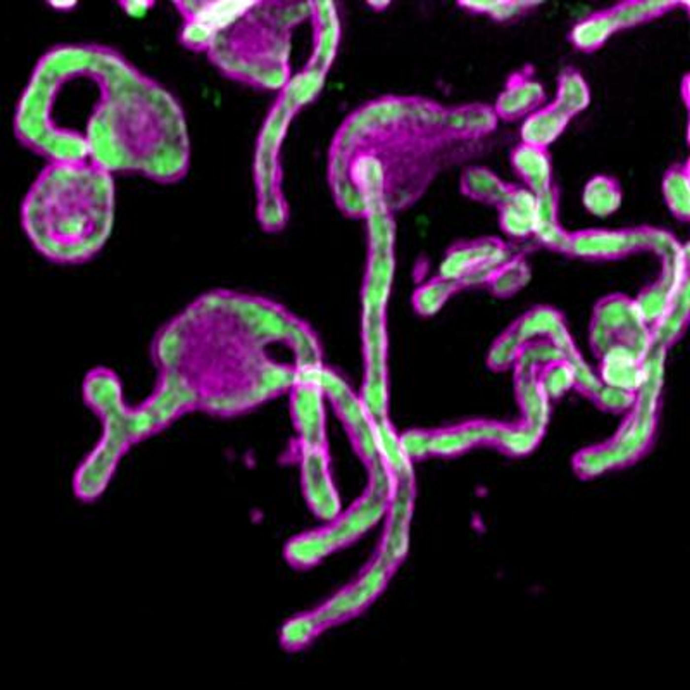 The microprotein PIGBOS (magenta) shown sitting on the outer membranes of mitochondria (green), where it is poised to make contact with other organelles in the cell. / Credit: Salk Institute/Waitt Advanced Biophotonics Core Facility