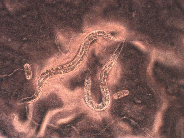 H. Mephisto (the Devil Worm). (microscopic image, magnified 200x) / Credit: Prof. John Bracht, American University
