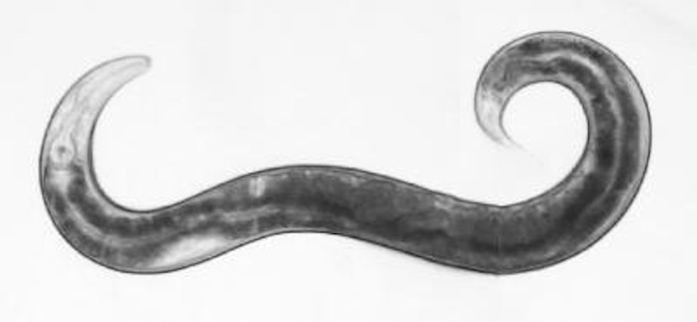 A nematode worm. / Credit: Erik Jorgensen, University of Utah.