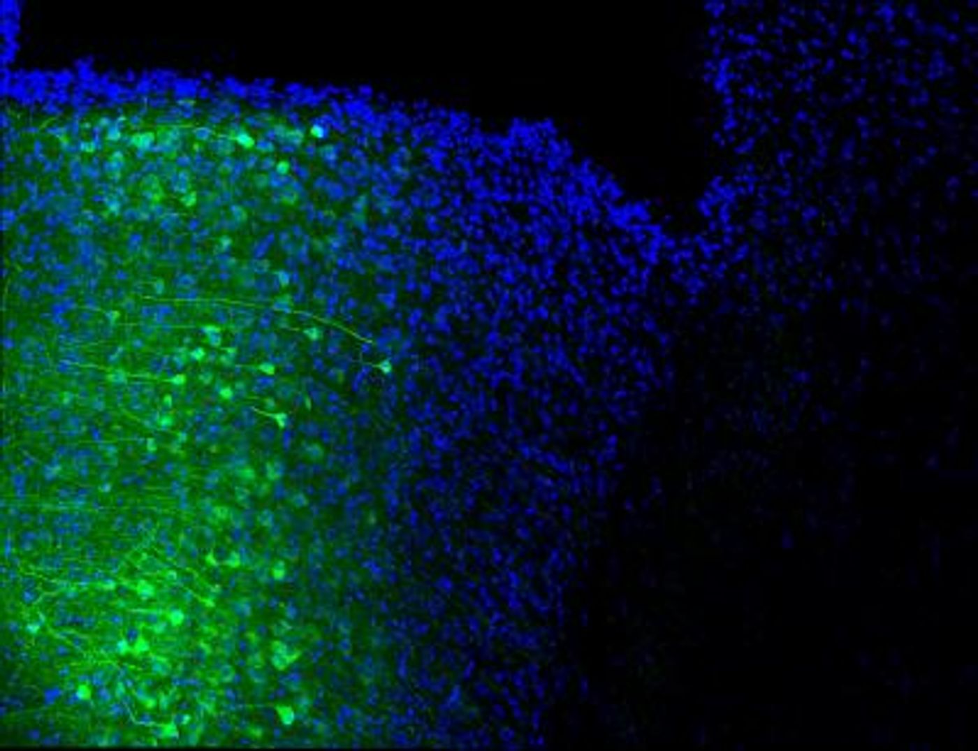 Nuclei (blue) of the medial prefrontal cortex neurons projecting their axons (green) to the periaqueductal gray area. / Credit: Salk Institute
