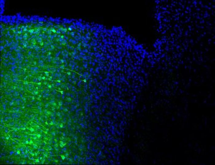 Nuclei (blue) of the medial prefrontal cortex neurons projecting their axons (green) to the periaqueductal gray area. / Credit: Salk Institute