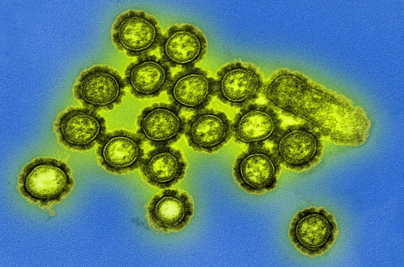 H3N2 influenza virions. / Credit: CDC/Michael Shaw, Doug Jordan
