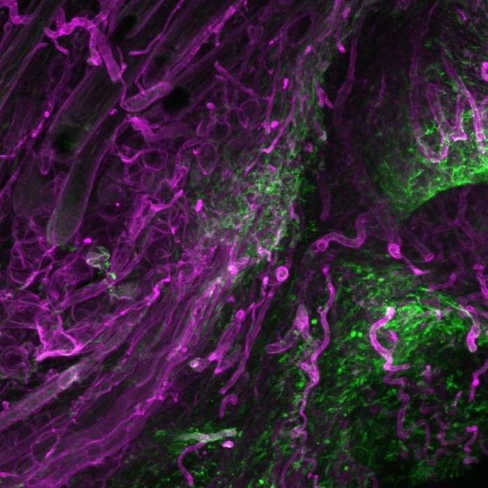 Fascia cells (green) rising into dermal open wounds dragging their surrounding matrix (magenta). / Credit: © Helmholtz Zentrum München / Donovan Correa -Gallegos