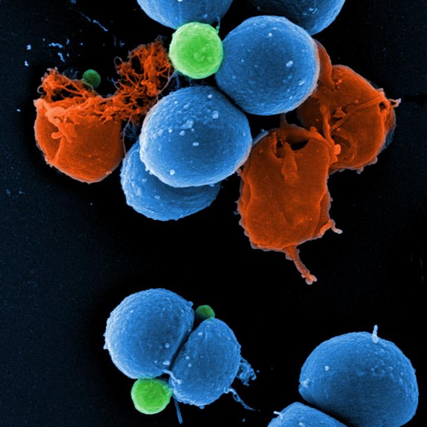Scanning electron micrograph of intact MRSA (blue), PK150-induced vesicle formation (green), and MRSA destroyed by PK150 (red). / Credit: Manfred Rohde / HZI