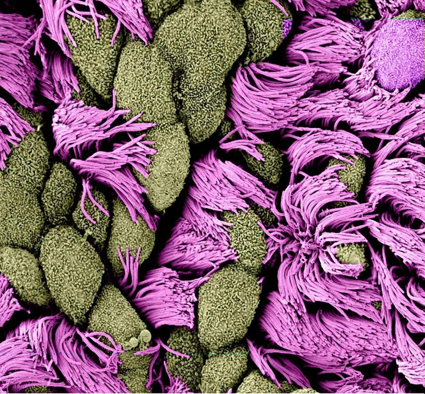 This is the surface of a multicillated cell. / Credit: Andrew Holland