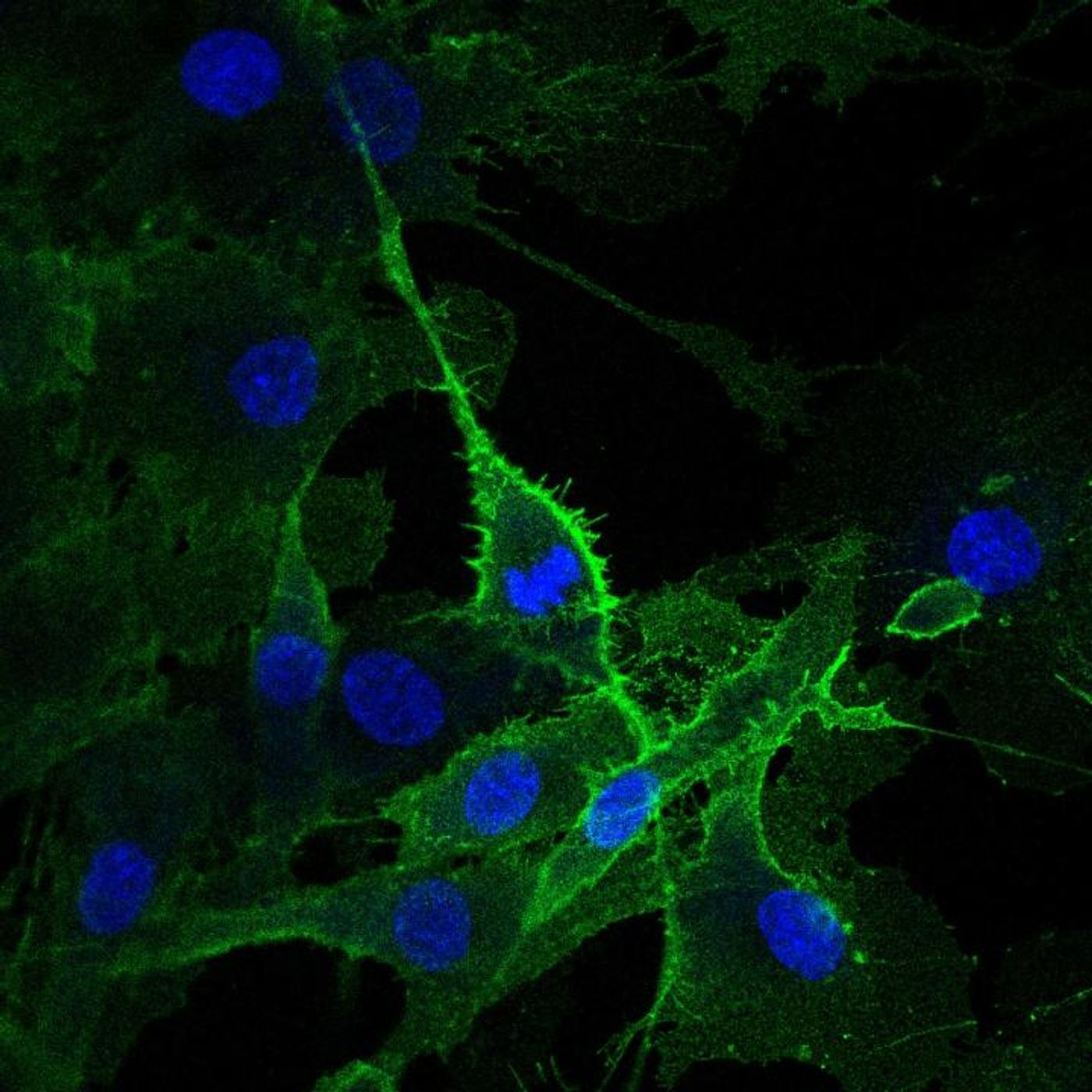 The patient's muscle cell population shows a very strong expression of the surface protein CLEC14A (green). / Credit: Spuler lab, MDC