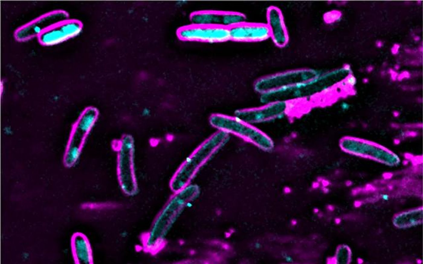 E. coli cells containing the CBASS system (pink oval shapes) destroy their (blue) genomes after bacteriophage lambda infection. Uninfected cells with intact genomes are at the top of the image. / Credit: UC San Diego Health Sciences