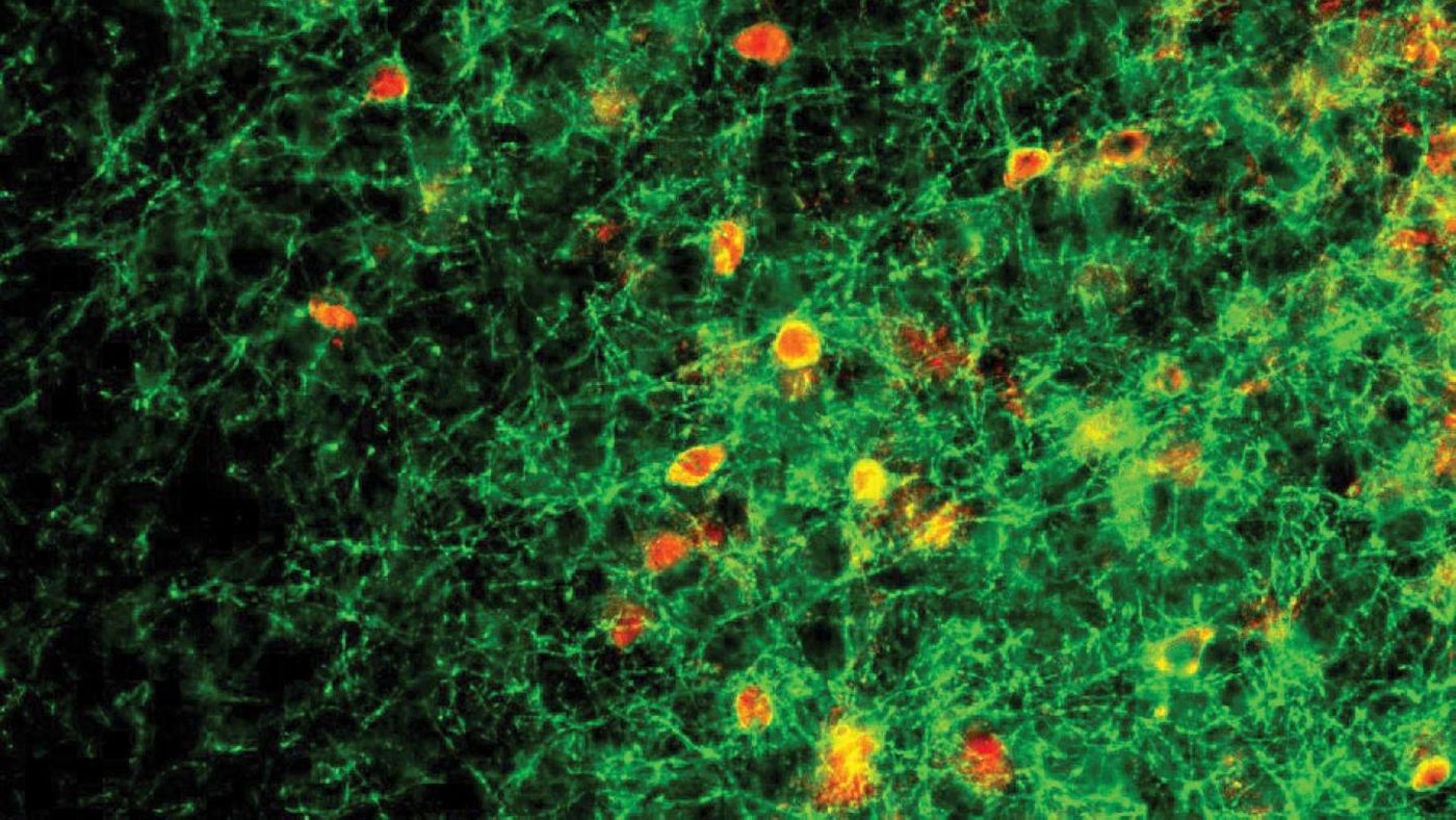 Abnormal behavior of parvalbumin (PV) neurons (in red) in the auditory cortex of the mouse brain manifests as parental neglect. Normal activity of PV neurons depends on the Mecp2 gene, without which female mice can't learn to respond to distress cries of young pups.  / Credit: Shea lab/CSHL, 2020