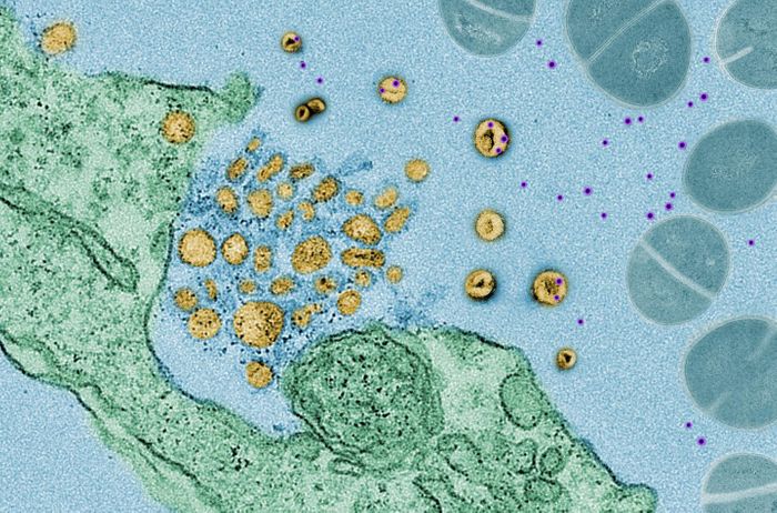 Electron microscopy images show 'exosomes' (in yellow) soaking up toxins (in purple) released by bacteria (in blue), which are trying to kill a human lung cell (in green). / Credit: Courtesy of Nature