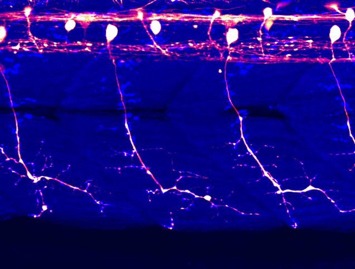 The whole cells of spinal motor neurons are visualized in an intact zebrafish larva (white/red). Skeletal muscles are shown in blue.  / Credit: (c) Kazuhide Asakawa