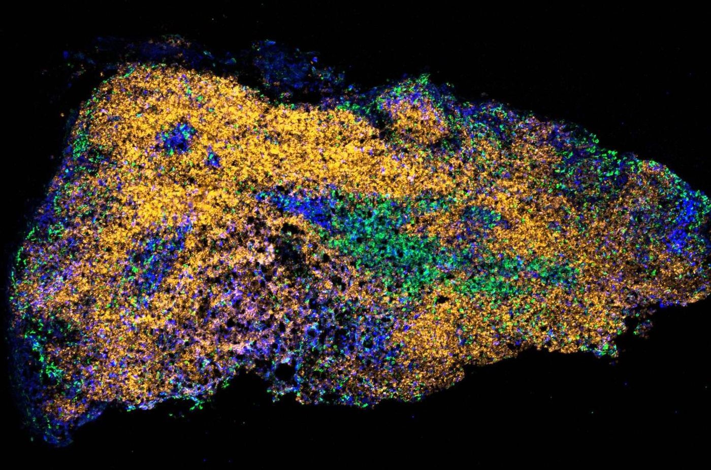 A mouse lymph node from an aged mouse 14 days after immunization. B cell follicles are yellow (IgD) and proliferating germinal centre cells (blue) are shown within the B cell follicle. T cells are green. / Credit: Babraham Institute
