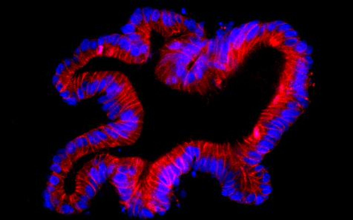 Fuorescent pictures of a human colon organoid stained for E-cadherin in red and DAPI in blue. / Credit: Dr Thierry Jarde