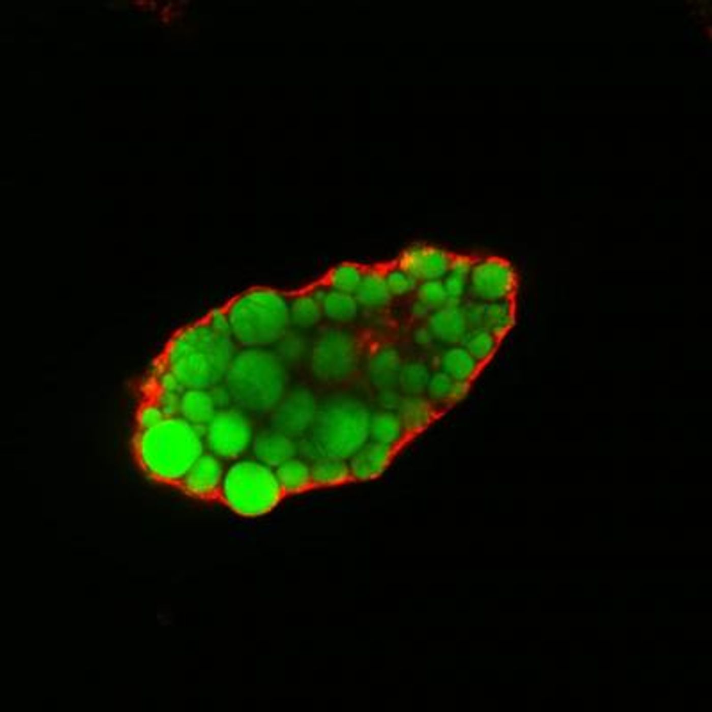 Lipid droplets (colored) in a fat cell that lacks EHD2. / Credit: Claudia Matthaeus, MDC