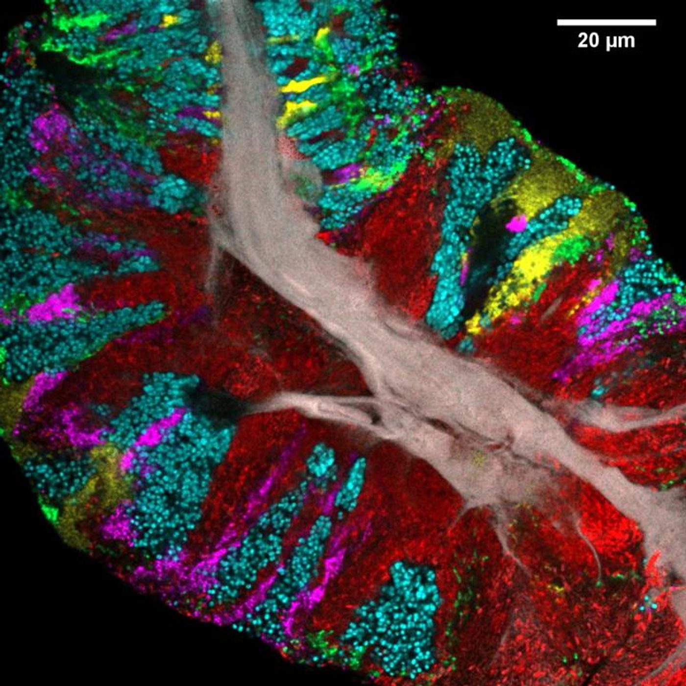 Bacterial biofilm scraped from the surface of the tongue and imaged using CLASI-FISH. Human epithelial tissue forms a central core (gray). Colors indicate different bacteria: Actinomyces (red) occupy a region close to the core; Streptococcus (green) is localized in an exterior crust and in stripes in the interior. Other taxa (Rothia, cyan; Neisseria, yellow; Veillonella, magenta) are present in clusters and stripes that suggest growth of the community outward from the central core./ Credit: Steven Wilbert and Gary Borisy, The Forsyth Institute