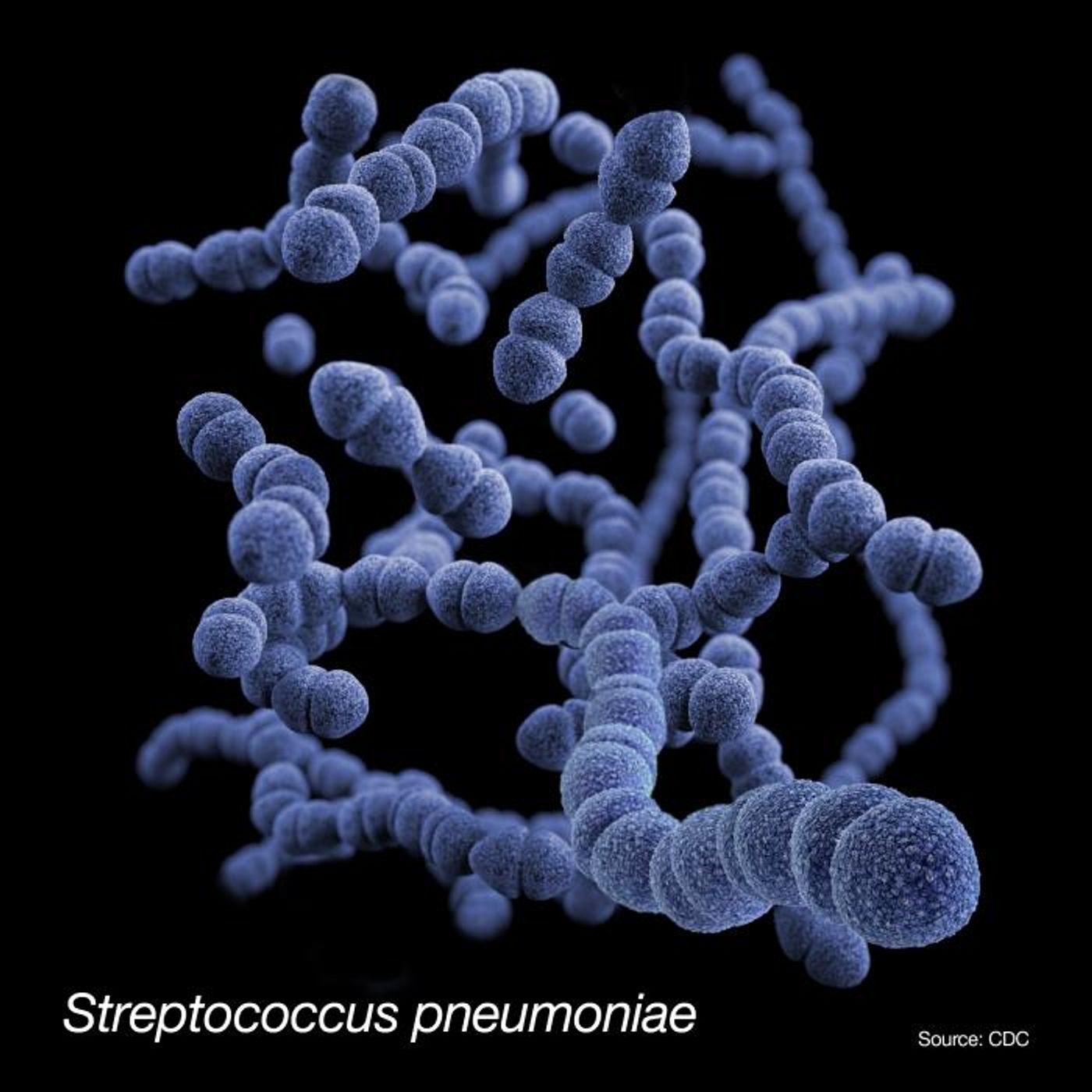 An illustration of a 3D, computer-generated image of Streptococcus pneumoniae bacteria.  / Credit: CDC/ Antibiotic Resistance Coordination and Strategy Unit / Dan Higgins - Medical Illustrator
