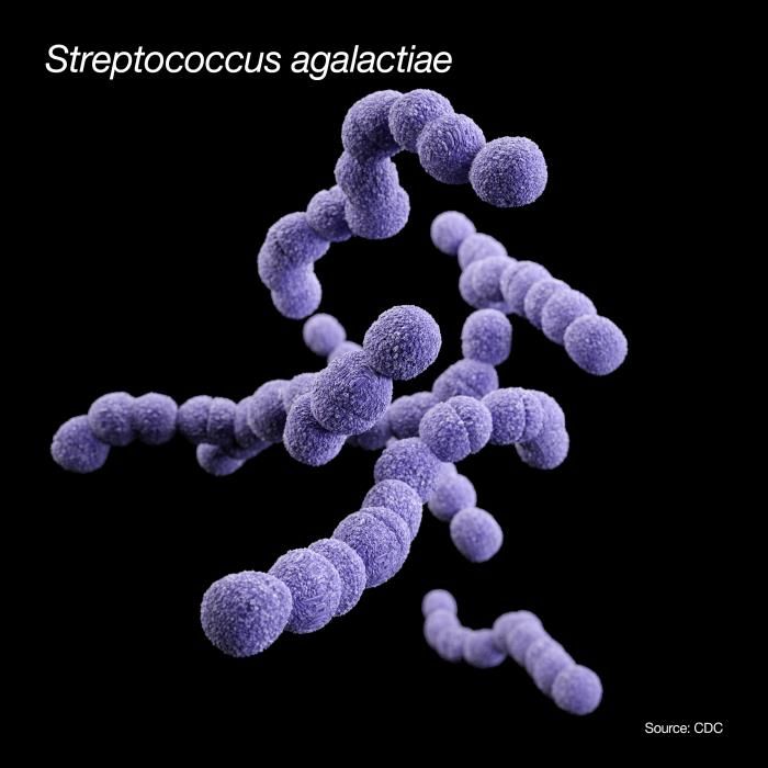 A 3D computer-generated image of a group of Gram-positive, Streptococcus agalactiae (group B Streptococcus) bacteria, based upon scanning electron microscopic (SEM) imagery. / Credit: CDC/ Sarah Bailey Cutchin