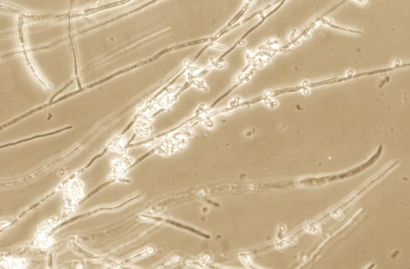 Candida albicans with hyphae / Credit: CDC/ Dr. Hardin