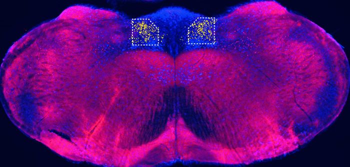 A region of the mouse brain known as the cNST (colored yellow at top) responded to the presence of sugar, even if it was infused directly into the gut. / Credit: Tan et al./Nature 2020