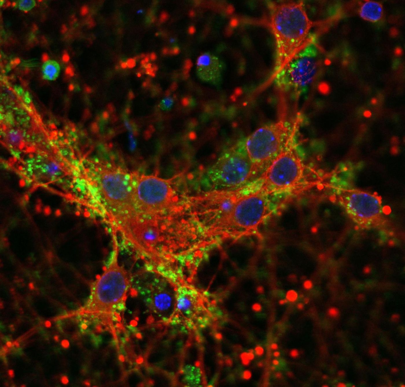 Microscopic image of mouse neurons to which the patient-derived α-synuclein protein was administered. The protein deposits (green) form after seven days. / Credit: Microscopy by Anke Van der Perren