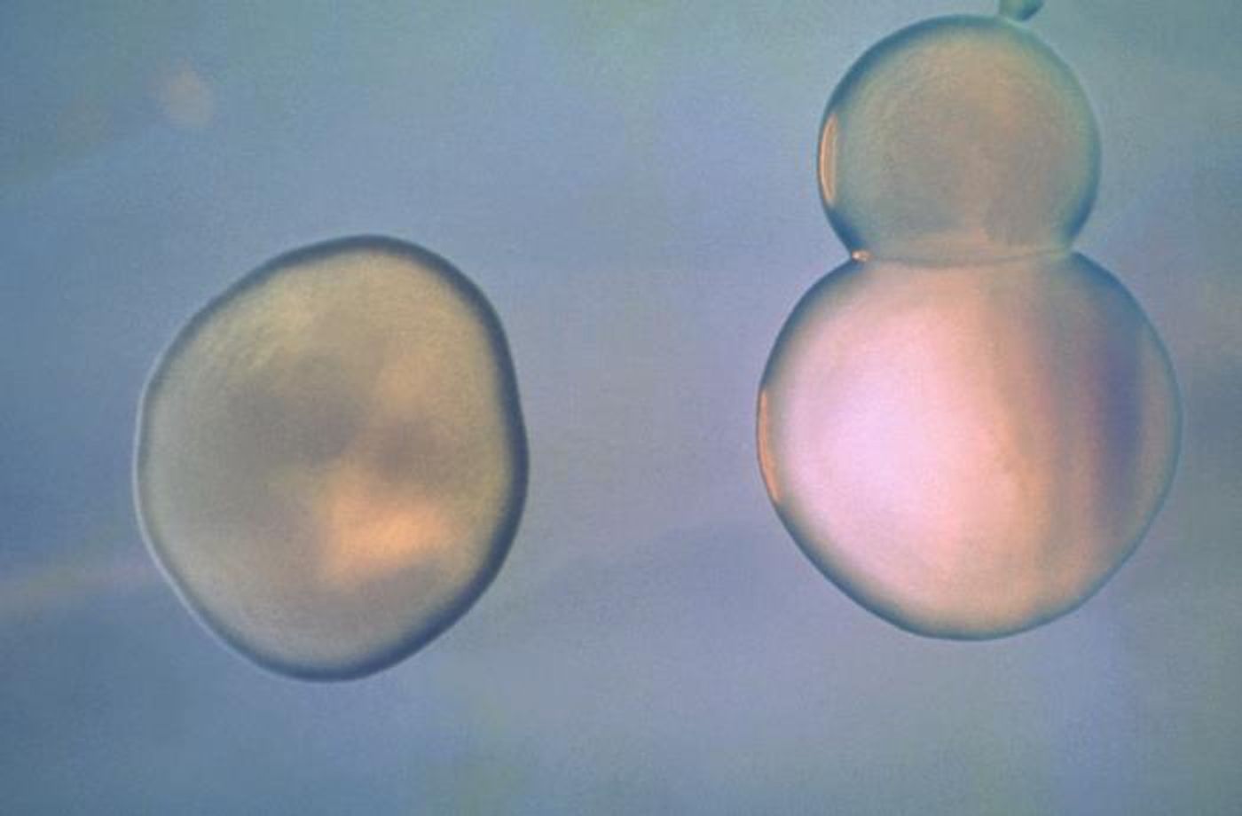 At left, with a smooth, gray-green surface, a Vibrio cholerae bacterial growth, while on the right, each exhibiting a smooth surface with a metallic sheen, are Escherichia coli bacterial organisms. / Credit: CDC/ Dr. W.H. Ewing