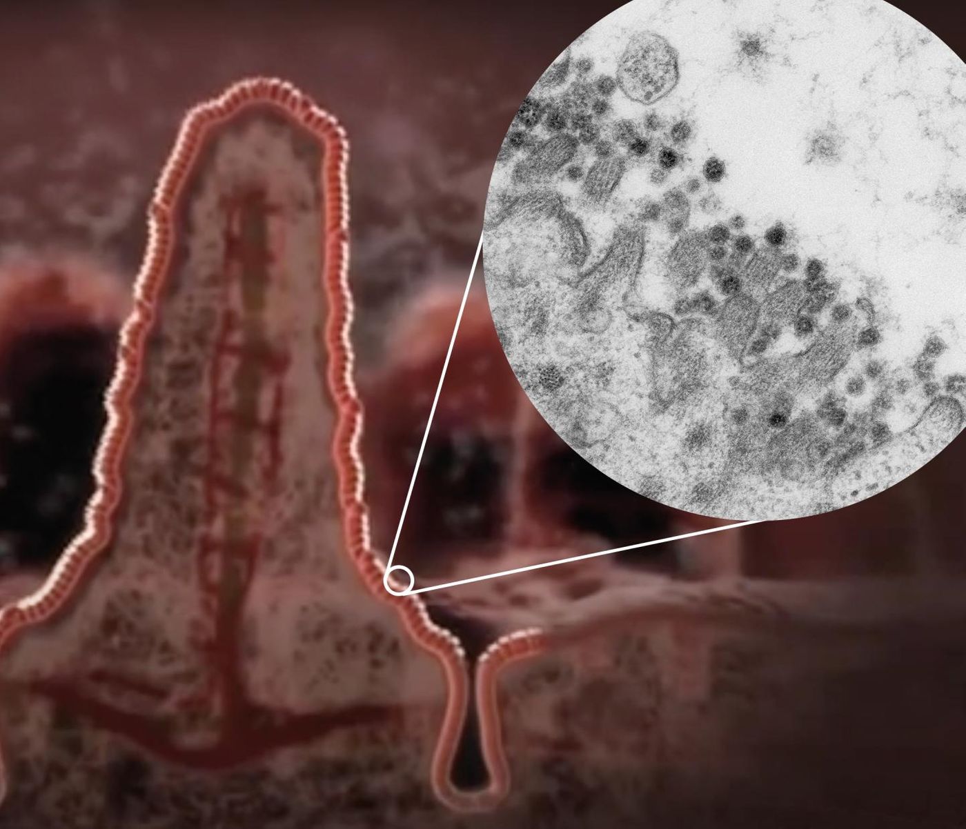 Illustration of a villus in the intestine with a zoom-in to an electron microscopy image of coronavirus SARS-CoV-2 (dark circles) at the edge of an intestinal cell. Credit  Credit: Kèvin Knoops, Raimond Ravelli and Maaike de Backer, copyright: Maastricht University