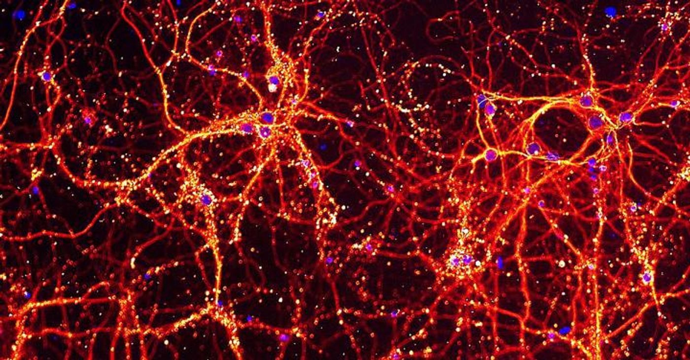 This image shows neurons and their connections to each other in red and yellow, and the cell's DNA in blue. These neurons were used to study the impact of Toxoplasma infection on cells. / Credit: Walter and Eliza Hall Institute, Australia