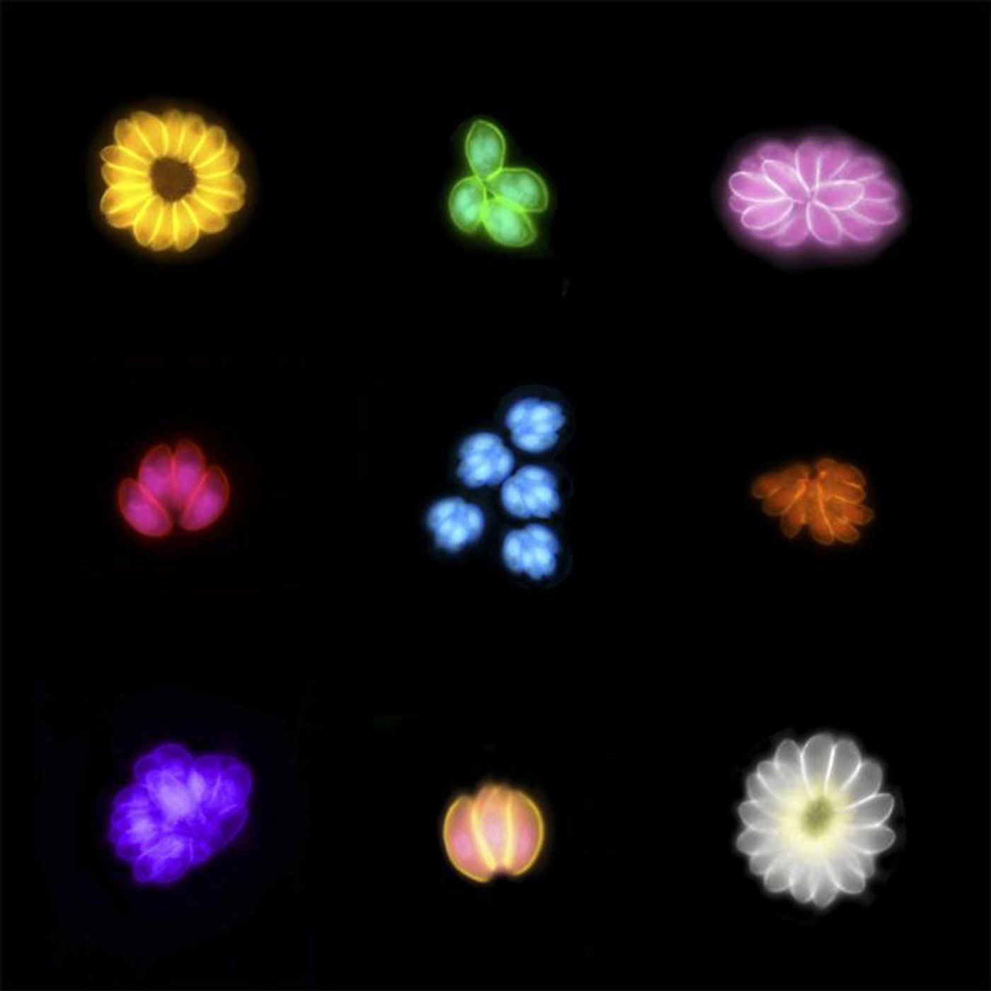 Toxoplasma parasites within cells can form these visually appealing 'bouquets' (which have been artificially coloured), but they can cause severe illness and long-lasting health impacts. Our latest research suggests Toxoplasma infection may also impact the brain health of subsequent generations. / Credit: Walter and Eliza Hall Institute, Australia