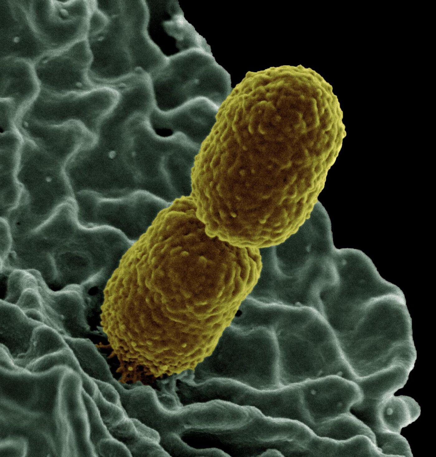 This is a colorized scanning electron micrograph image of Klebsiella pneumoniae interacting with a human neutrophil, a type of white blood cell. / Credit: National Institute of Allergy and Infectious Diseases