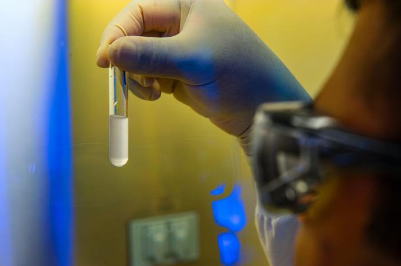 A scientist looks at a bacteria culture tube / Credit: CDC/ Daniel Drapeau 