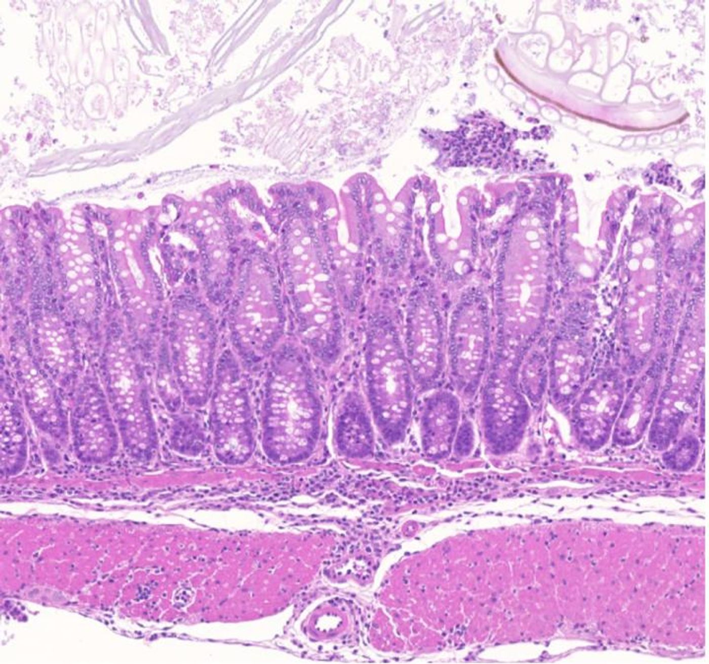 Gut inflammation in mice lacking a homologue of a distal enhancer found at the human chromosome 11q13.5 disease risk locus. / Credit: The Babraham Institute