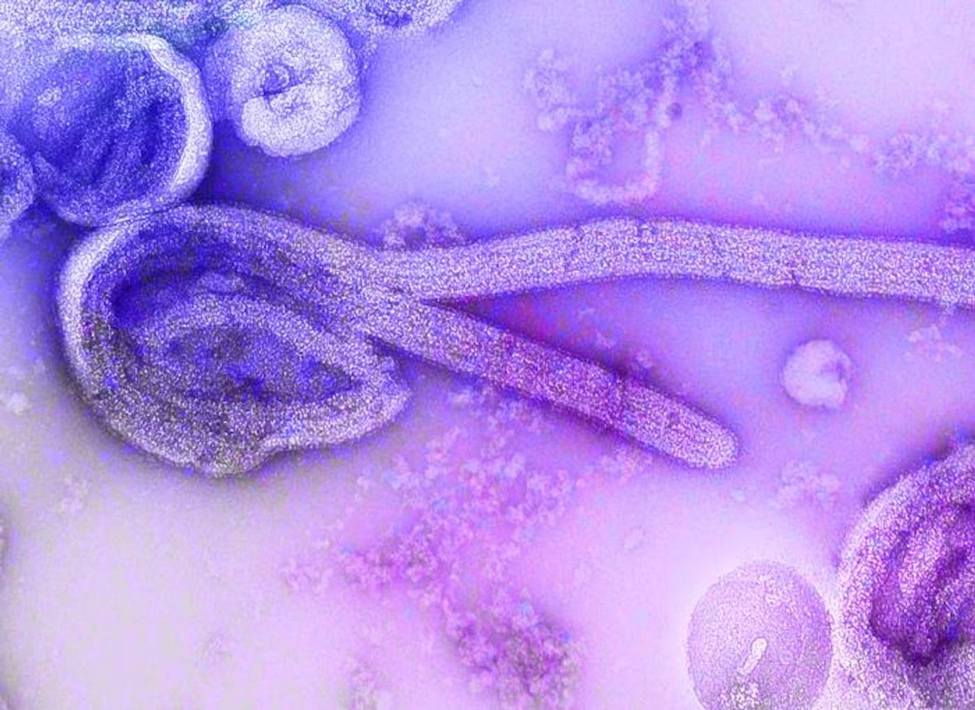 An electron microscopic image of an isolate of Marburg virus, which is similar in morphology to Ebola virus.  / Credit: CDC/ Dr. Frederick Murphy