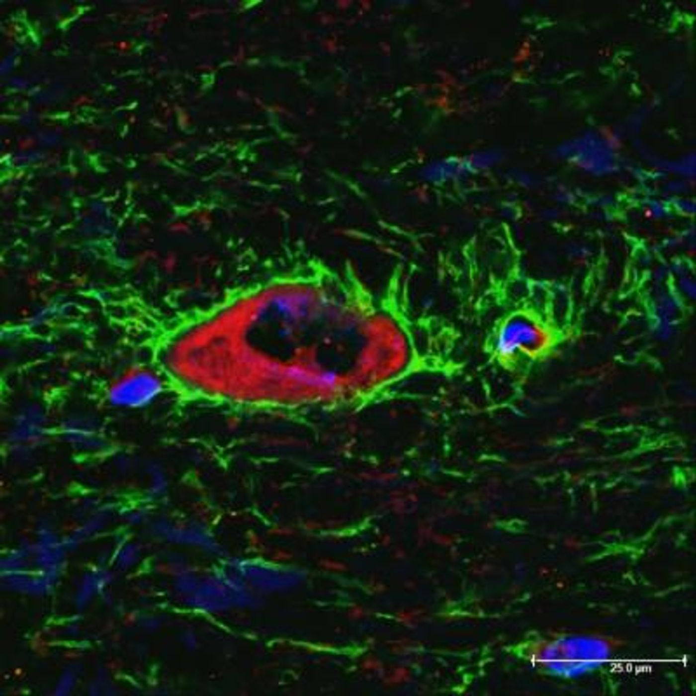 Researchers have discovered a new treatment for brain and spinal cord injuries by manipulating cell functions using an already-licensed medicine. / Credit: Philip Kitchen, School of Life and Health Sciences, Aston University (UK)