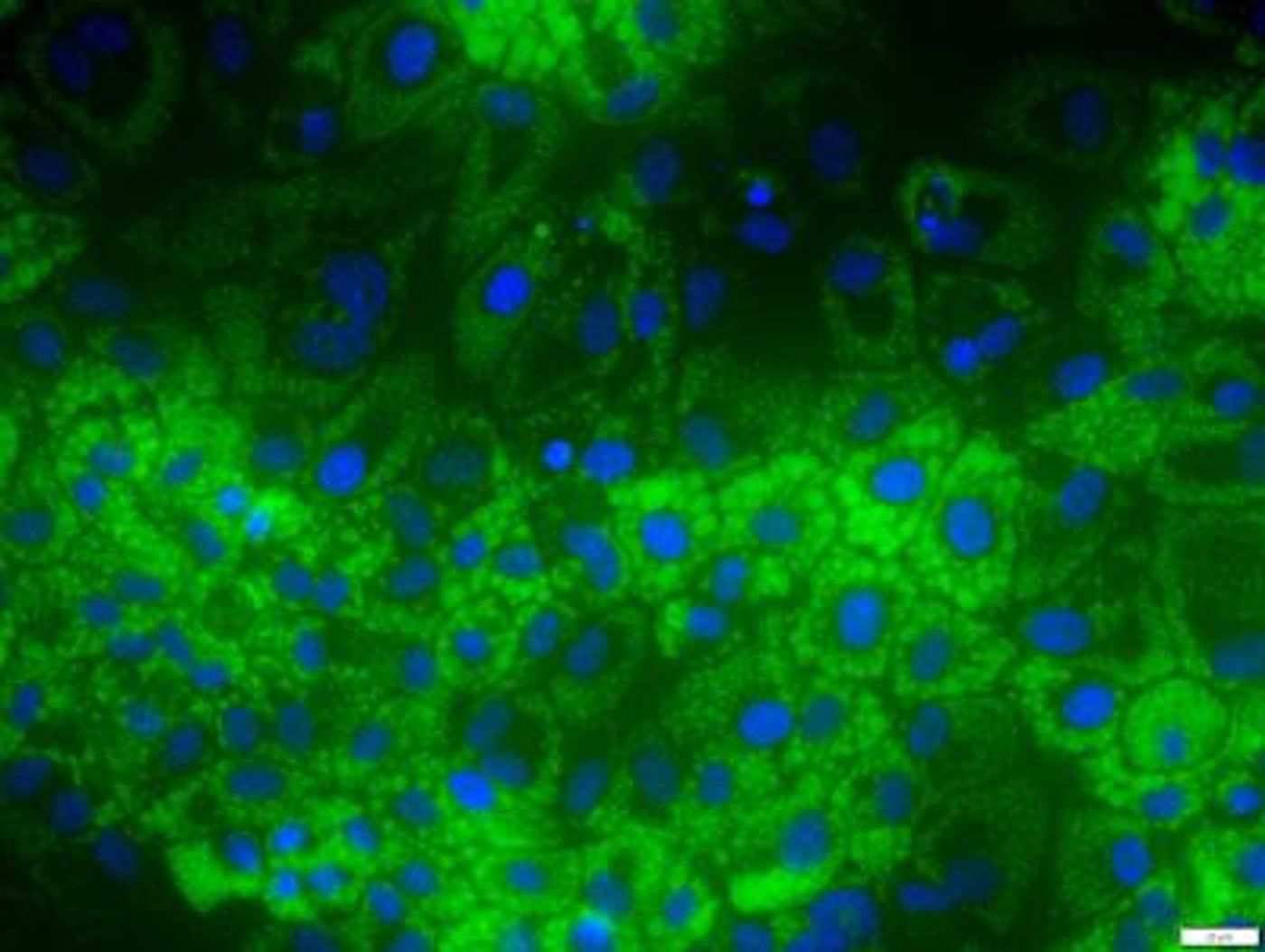 Liver cells (blue) accumulating lipids (green). / Credit: Baylor University
