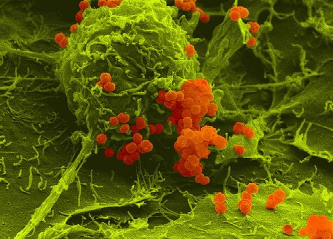 False color scanning electron micrograph of meningococci (orange) adherent to human host cells (green). Credit: Alexandra Schubert-Unkmeir / University of Wuerzburg