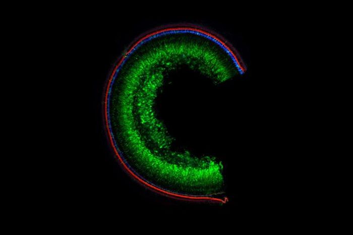 A laser scanning confocal microscope image of the mouse cochlea, the inner ear hearing organ. Sensory cell bodies are stained in blue, sensory organelles in red, and cells with repaired Tmc1 gene in green. / Credit: Olga Shubina-Oleinik, Boston Children's Hospital