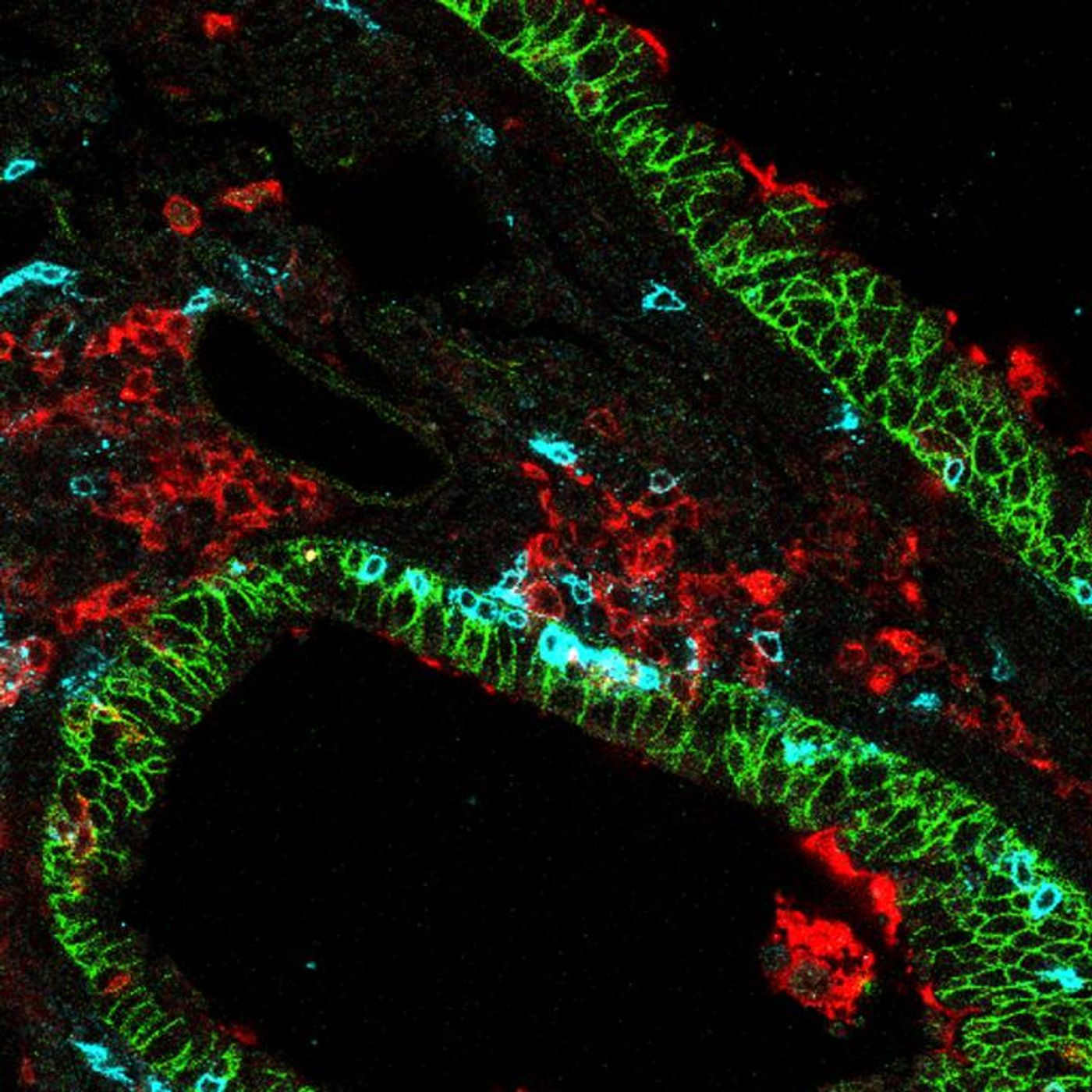 Lung-specific CD8 killer T cells (blue) in lung tissue (green) surrounded by dendritic lung cells (red). / Credit: Salk Institute