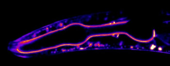 Duke University researchers used gene-editing techniques to tag and light up proteins in the basement membranes of living worms and watch them in action using time-lapse microscopy. / Credit: By Dan Keeley, UNC Chapel Hill
