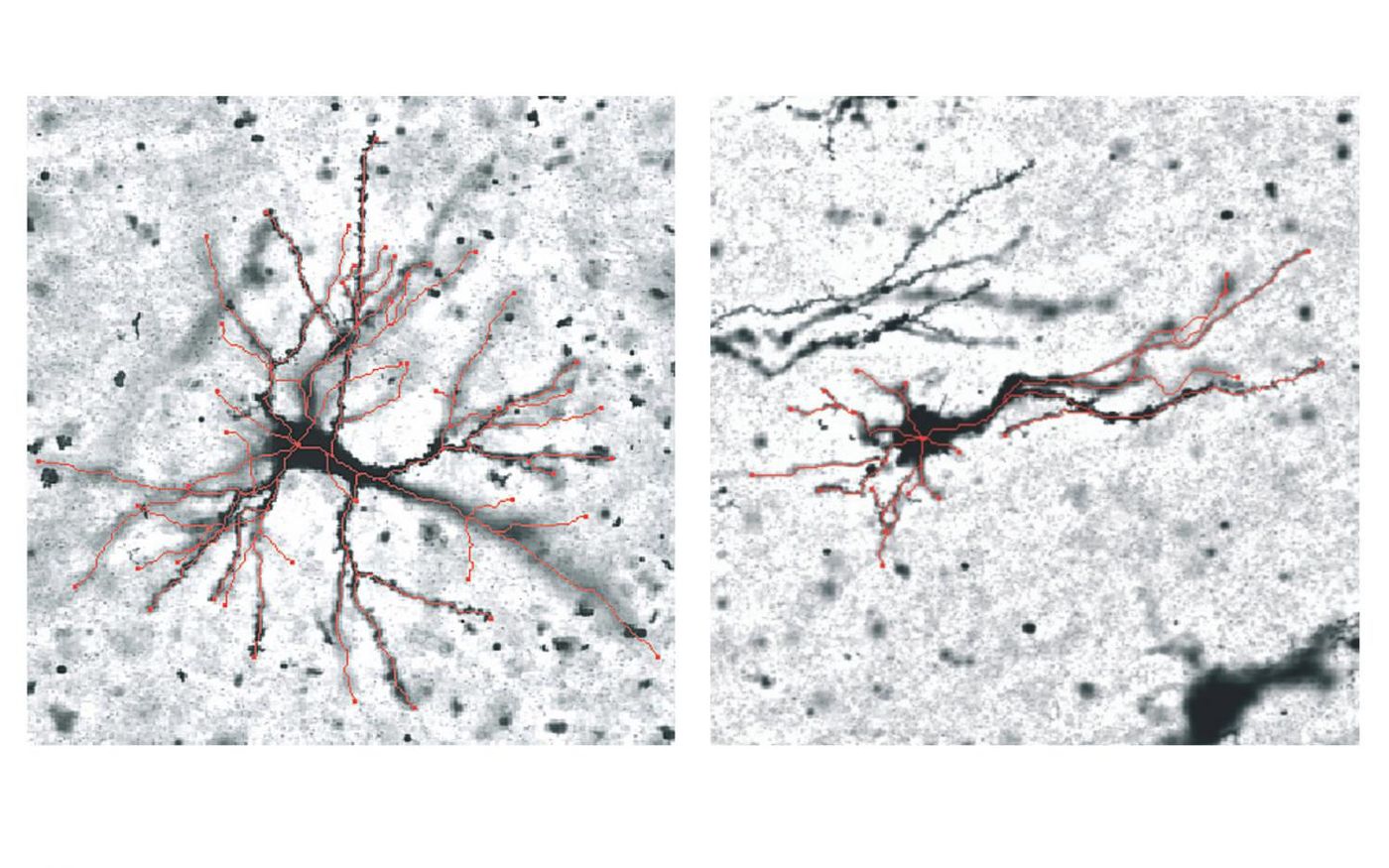 Grey matter neurons in the outward folds (left) and inward folds (right), differences shown in red. . / Credit: RMIT University