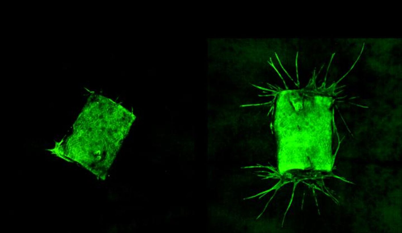 Aorta tissues that were not exposed to BafA (left) did not sprout new vessels, while BafA-exposed aorta tissues (right) did. / Credit: Kentaro Tsukamoto