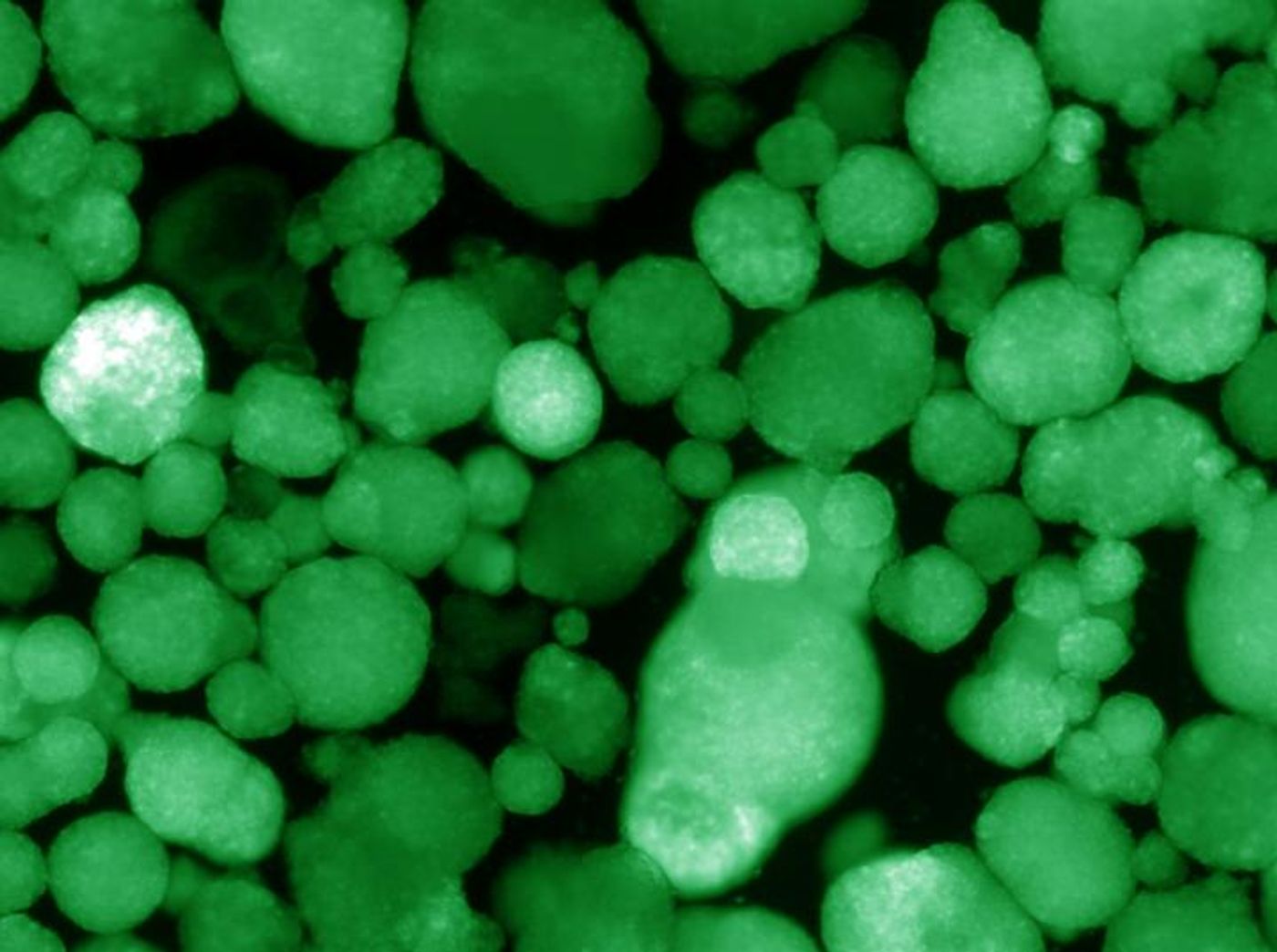 Shown here, human islet-like organoids express insulin, which is indicated by the green color. / Credit: Salk Institute