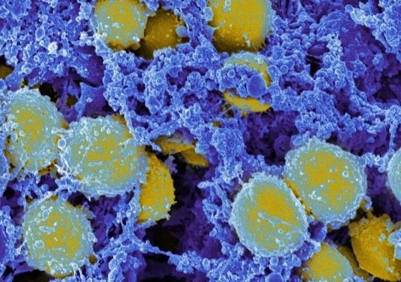 Scanning electromicrograph of Staphylococcus aureus bacteria. / Credit: NIAID