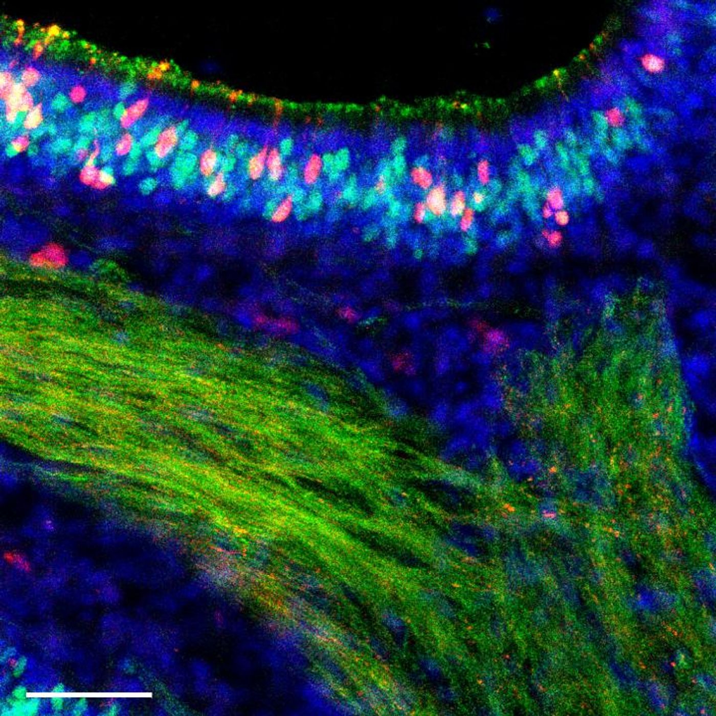 Fourteen days after infection with an influenza B virus, cells of a mouse nose are colored to show any remaining infection. Red cells were infected but have now cleared the virus. Green indicates the sensory neurons and yellow shows where red and green have overlapped. / Credit: Sebastian Wellford, Moseman Lab, Duke University