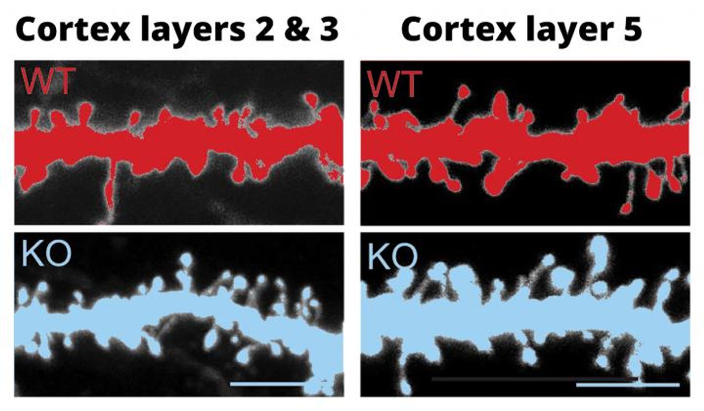 Dendritic spines of cortical neurons in layers II and III (left) and layer V (right) in 4-week-old wildtype (top) and FABP4 KO mice (bottom). Like postmortem brains of people with autism spectrum disorders, the number and density of dendritic spines was greater in the FABP4 KO mice than in the control mice. / Credit: RIKEN
