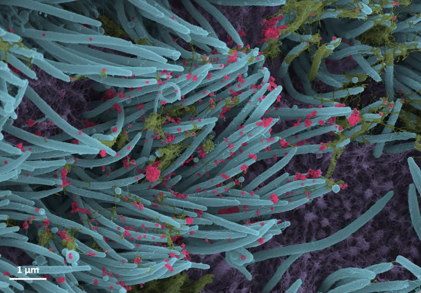 A higher power magnification image shows the structure and density of SARS-CoV-2 virions (red) produced by human airway epithelia. / Credit:  Ehre Lab, UNC School of Medicine