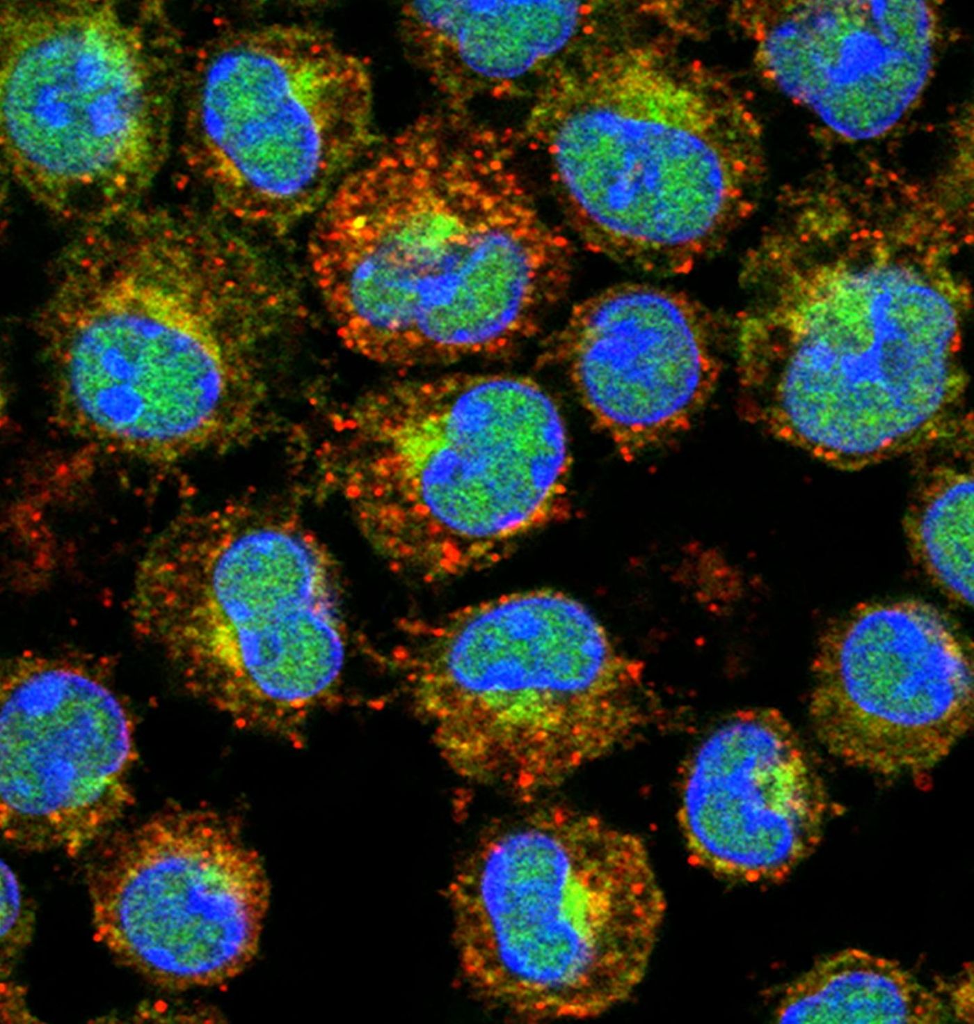 This research shows that it's our perinatal hormones, not our adult sex hormones, that have a greater influence on our risk of developing mast cell-associated disorders throughout the lifespan. / Credit: Michigan State University