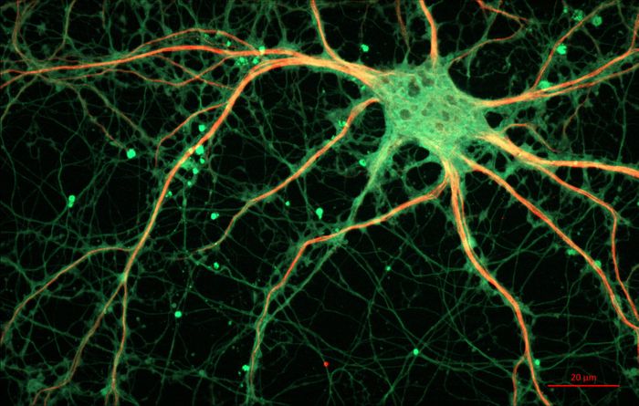 Fluorescent Microscopy image of a neuronal cell. Credit: ZEISS Microscopy