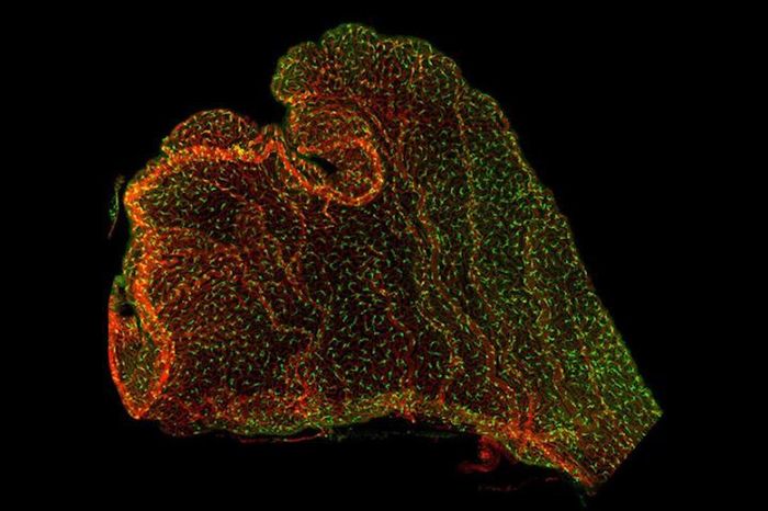 Immune cells (in green) on the mouse choroid plexus, with blood vessels in red. / Credit: Shipley et al., Neuron 2020, https://doi.org/10.1016/j.neuron.2020.08.024