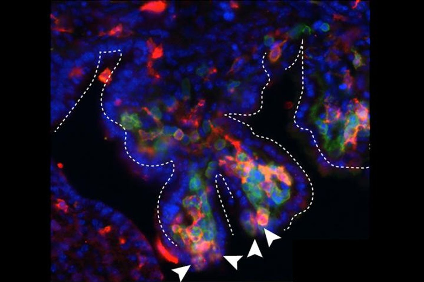 The arrowheads show immune cells (red, macrophages; green, leukocytes) gathered at "hotspots" in the choroid plexus, from which they appear to enter the cerebrospinal fluid. / Credit: Jin Cui, PhD, Boston Children's Hospital