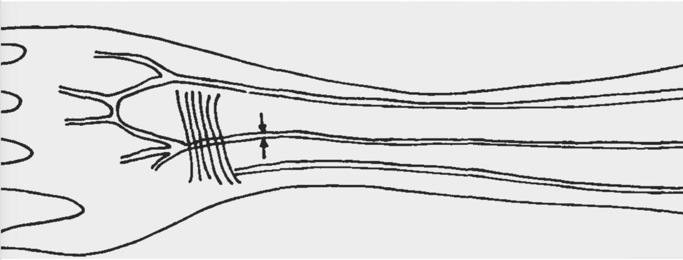 Sketch of median artery in human forearm / Credit: Prof. Dr. Hab. Maciej Henneberg, University of Zurich